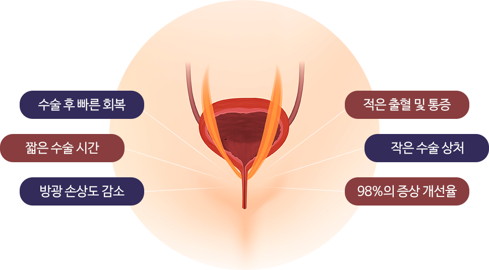 수술 후 빠른 회복, 짧은 수술 시간, 방광 손상도 감소, 적은 출혈 및 통증, 작은 수술 상처, 98%의 증상 개선율