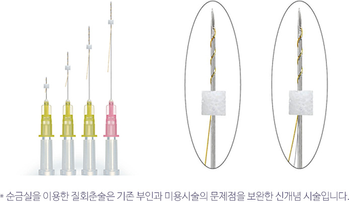 * 순금실을 이용한 질회춘술은 기존 부인과 미용시술의 문제점을 보완한 신개념 시술입니다.