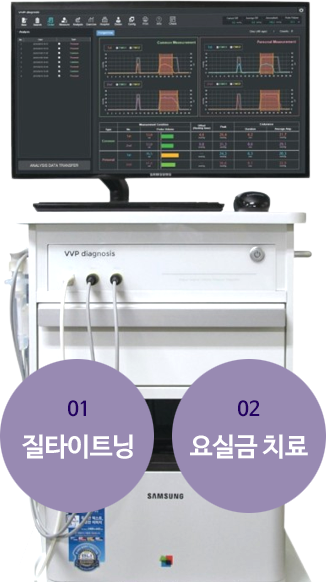 01 질타이트닝 / 02 요실금 치료